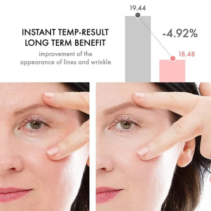 Professional Retinol Anti-Wrinkle Eye Cream